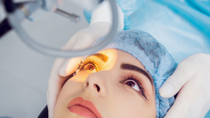 All You Need to Know About Cataract Surgery in Singapore