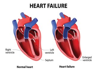 you reduce heart failure symptoms