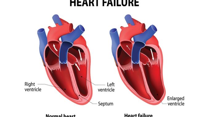 you reduce heart failure symptoms
